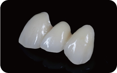 REECHMERRY Bridge — nano-zirconia dental restoration