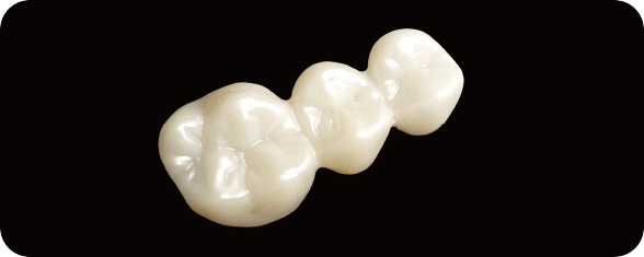 REECHMERRY Multi-Unit Long-Span Bridge — nano-zirconia dental restoration