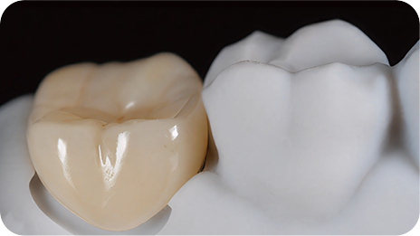 REECHFIRM Posterior single crowns — clinical indication